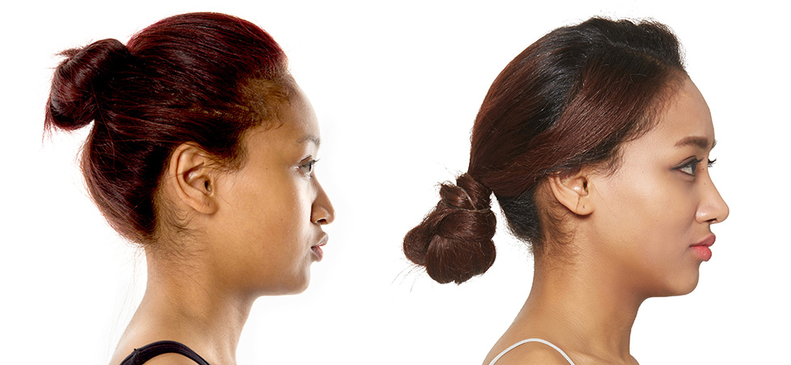 Slider image (4) JK Plastic Surgery 